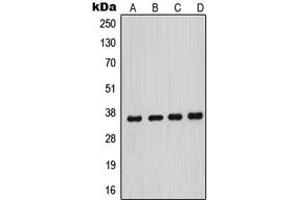 Western blot analysis of MNAT1 expression in HeLa (A), MCF7 (B), A431 (C), NIH3T3 (D) whole cell lysates. (MNAT1 antibody  (Center))