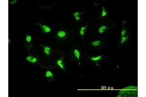 Immunofluorescence of monoclonal antibody to HDAC11 on HeLa cell. (HDAC11 antibody  (AA 1-347))