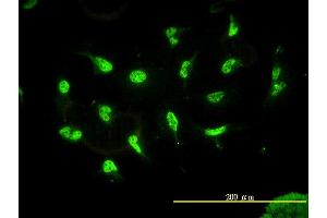Immunofluorescence of monoclonal antibody to HDAC11 on HeLa cell.