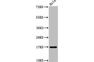 Western Blot Positive WB detected in: Hela whole cell lysate All lanes: C1D antibody at 3. (C1D antibody  (AA 1-135))