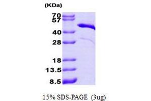 SDS-PAGE (SDS) image for Troponin T (Tn T) (AA 1-285) protein (His tag) (ABIN667741)