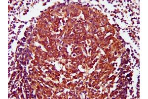 IHC image of ABIN7147144 diluted at 1:800 and staining in paraffin-embedded human lymph node tissue performed on a Leica BondTM system. (CD27 antibody  (AA 20-191))