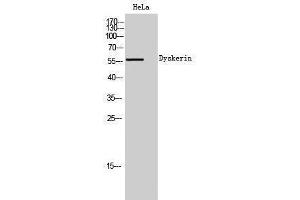 Western Blotting (WB) image for anti-Dyskeratosis Congenita 1, Dyskerin (DKC1) (Internal Region) antibody (ABIN3174847) (DKC1 antibody  (Internal Region))