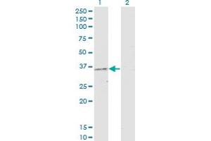 Western Blotting (WB) image for anti-Protein Kinase, AMP-Activated, gamma 2 Non-Catalytic Subunit (PRKAG2) (AA 191-300) antibody (ABIN565604)