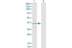 Western Blot analysis of PRKAG2 expression in transfected 293T cell line by PRKAG2 monoclonal antibody (M01), clone 3C4. (PRKAG2 antibody  (AA 191-300))