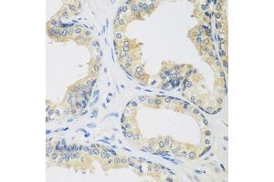 Immunohistochemistry of paraffin-embedded human prostate using UPF2 antibody. (RENT2/UPF2 antibody  (AA 1153-1272))
