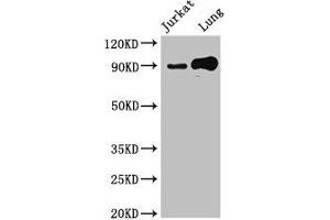 Western Blot Positive WB detected in: Jurkat whole cell lysate, Mouse lung tissue All lanes: STAT5B antibody at 2. (STAT5B antibody  (AA 40-280))