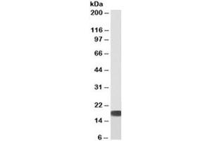 Western blot of human HEK293 cell lysate with biotinylated SOD antibody at 0. (SOD1 antibody  (Biotin))