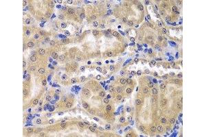Immunohistochemistry of paraffin-embedded Mouse kidney using RPL5 Polyclonal Antibody at dilution of 1:200 (40x lens). (RPL5 antibody)