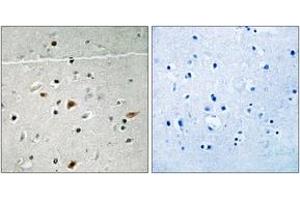 Immunohistochemistry analysis of paraffin-embedded human brain, using LIMK2 (Phospho-Ser283) Antibody. (LIMK2 antibody  (pSer283))
