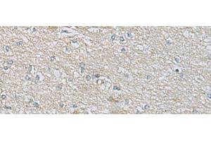 Immunohistochemistry of paraffin-embedded Human brain tissue using CDH12 Polyclonal Antibody at dilution of 1:60(x200) (Cadherin 12 antibody)