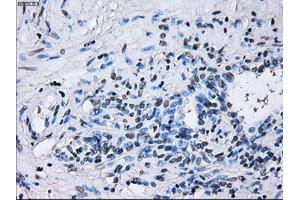 Immunohistochemical staining of paraffin-embedded Ovary tissue using anti-RNF144Bmouse monoclonal antibody.