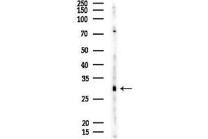 Western blot analysis of lysates from EC304 cells, using C Antibody at 1/1000 dilution.
