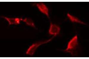 ABIN6272657 staining Hela by IF/ICC. (C-Type Lectin Domain Family 6, Member A (CLEC6A) (Internal Region) antibody)