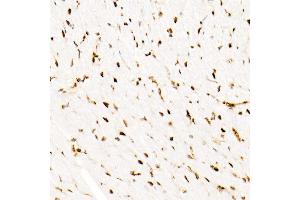 Immunohistochemistry of paraffin-embedded Mouse heart using SM/SNF5 antibody (ABIN7270657) at dilution of 1:1000 (40x lens). (SMARCB1 antibody)