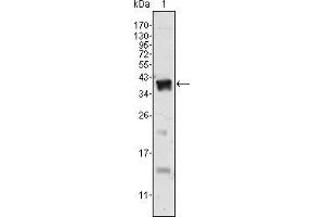 Western blot analysis using Androgen receptor mAb against human Androgen receptor (AA: 221-321) recombinant protein.