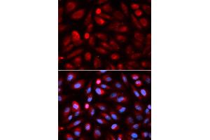 Immunofluorescence analysis of U2OS cell using ACP5 antibody. (ACP5 antibody  (AA 76-325))