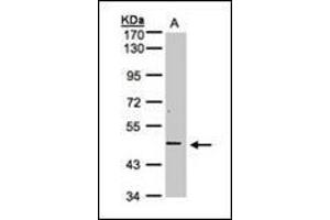 Sample(30 ug whole cell lysate). (DR3/LARD antibody)