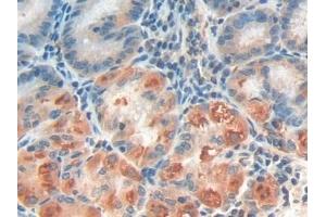 Detection of IFNa/bR1 in Human Stomach Tissue using Polyclonal Antibody to Interferon Alpha/Beta Receptor 1 (IFNa/bR1) (IFNAR1 antibody  (AA 28-227))