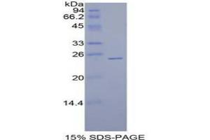 SDS-PAGE analysis of Human Sprouty Homolog 1 Protein. (SPRY1 Protein)