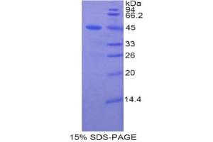 SDS-PAGE analysis of Rat Lipocalin 8 Protein. (LCN8 Protein)