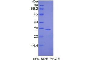 SDS-PAGE analysis of Mouse Desmocollin 1 Protein.