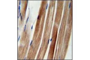 Immunohistochemistry analysis in formalin fixed and paraffin embedded human skeletal muscle reacted with KIAA1310 Antibody (Center) followed which was peroxidase conjugated to the secondary antibody and followed by DAB staining. (KANSL3 antibody  (Middle Region))