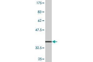 Western Blot detection against Immunogen (36. (PEX6 antibody  (AA 881-980))