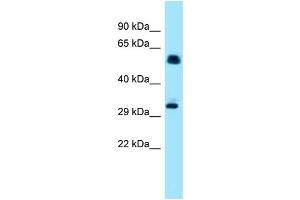 Western Blotting (WB) image for anti-Inositol Hexakisphosphate Kinase 1 (IP6K1) (N-Term) antibody (ABIN2789109) (IP6K1 antibody  (N-Term))