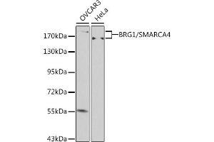 Western blot analysis of extracts of various cell lines, using BRG1/BRG1/SM antibody (ABIN6133730, ABIN6148100, ABIN6148101 and ABIN7101348) at 1:500 dilution. (SMARCA4 antibody  (AA 30-130))