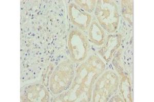 Immunohistochemistry of paraffin-embedded human kidney tissue using ABIN7171148 at dilution of 1:100 (SNAP29 antibody  (AA 1-258))
