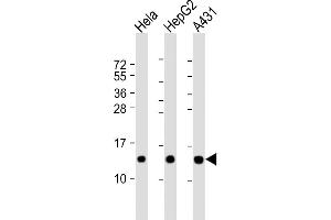 All lanes : Anti-NDUFB3 Antibody (N-Term) at 1:2000 dilution Lane 1: Hela whole cell lysate Lane 2: HepG2 whole cell lysate Lane 3: A431 whole cell lysate Lysates/proteins at 20 μg per lane.