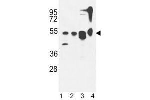 ATG13 antibody western blot analysis in 1) MDA-MB435,2) CEM, 3) T47D cell line and 4) mouse cerebellum tissue lysate. (ATG13 antibody  (AA 1-30))