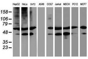 Image no. 2 for anti-Tubulin, alpha-Like 3 (TUBAL3) (AA 150-446) antibody (ABIN1490960) (TUBAL3 antibody  (AA 150-446))