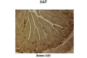 Sample Type :  Pig duodenum   Primary Antibody Dilution :   1:500  Secondary Antibody :  Anti-rabbit-biotin, streptavidin-HRP   Secondary Antibody Dilution :   1:500  Color/Signal Descriptions :  Brown: OAT  Gene Name :  OAT   Submitted by :  Juan C. (OAT antibody  (C-Term))