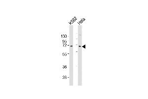 All lanes : Anti-ZN Antibody (C-term) at 1:2000 dilution Lane 1: K562 whole cell lysates Lane 2: Hela whole cell lysates Lysates/proteins at 20 μg per lane. (ZNF257 antibody  (C-Term))
