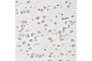Immunohistochemistry of paraffin-embedded rat brain using COPB2 antibody (ABIN2561951) at dilution of 1:100 (40x lens).