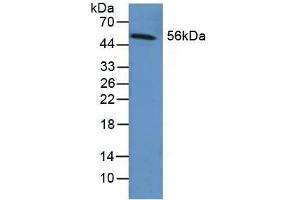 Detection of FGB in Human Liver Tissue using Polyclonal Antibody to Fibrinogen Beta Chain (FGB) (Fibrinogen beta Chain antibody  (AA 29-118))