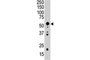 Western blot analysis of PDK2 polyclonal antibody  in mouse intestine tissue lysate (35 ug/lane). (PDK2 antibody  (AA 378-407))