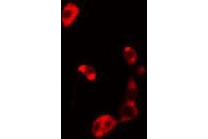 ABIN6274830 staining HuvEc cells by IF/ICC. (AKR1B1 antibody  (C-Term))