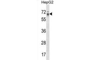 Western Blotting (WB) image for anti-rho GTPase Activating Protein 36 (ARHGAP36) antibody (ABIN2998590) (ARHGAP36 antibody)