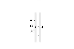TGM2 Antibody (Center ) (ABIN392285 and ABIN2841950) western blot analysis in HUVEC,K562 cell line lysates (35 μg/lane). (Transglutaminase 2 antibody  (AA 429-458))
