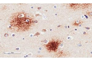 Immunohistochemical staining of human Alzheimer's disease hippocampus tissue using anti-Amyloid Beta antibody. (Recombinant beta Amyloid antibody)