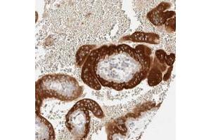 Immunohistochemical staining of human placenta with LETM2 polyclonal antibody  shows strong cytoplasmic positivity in trophoblastic cells at 1:200-1:500 dilution.