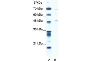 Western Blotting (WB) image for anti-Pancreatic Lipase (PNLIP) antibody (ABIN2460823)