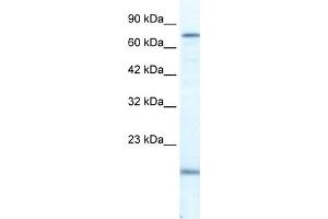 WB Suggested Anti-PGBD3 Antibody Titration:  2. (PGBD3 antibody  (N-Term))