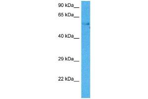 Host:  Mouse  Target Name:  HSF2  Sample Tissue:  Mouse Testis  Antibody Dilution:  1ug/ml (HSF2 antibody  (Middle Region))