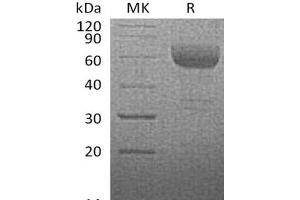 Western Blotting (WB) image for Tumor Necrosis Factor Receptor Superfamily, Member 14 (TNFRSF14) protein (Fc Tag) (ABIN7321001) (HVEM Protein (Fc Tag))