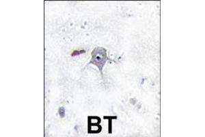 Formalin-fixed and paraffin-embedded human brain tissue reacted with PIK3R2 Antibody (N-term) Ap8028a , which was peroxidase-conjugated to the secondary antibody, followed by DAB staining. (PIK3R2 antibody  (N-Term))