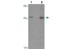 Western blot analysis of PTPRD in HeLa cell lysate with PTPRD polyclonal antibody  at (lane 1) 1 and (lane 2) 2 ug/mL.